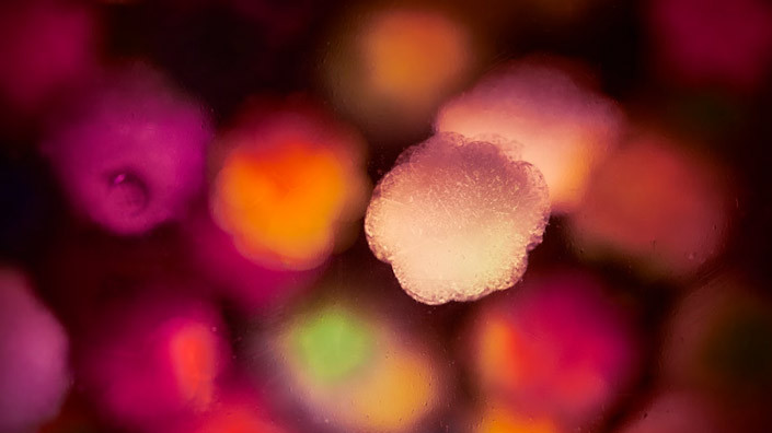 @Unsplash